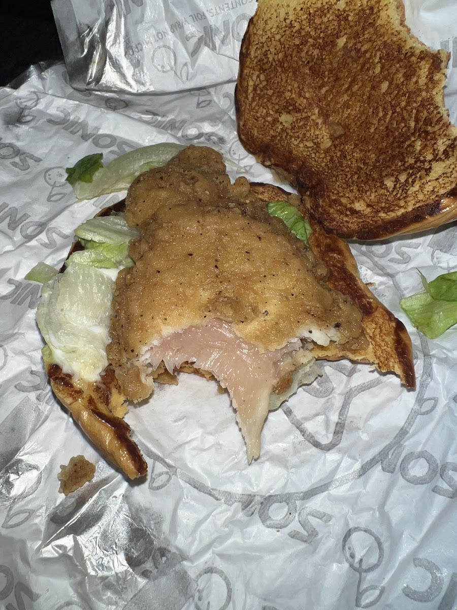Sonic Drive-In Photo 8